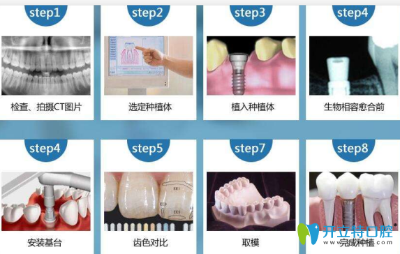 普通種植牙過程