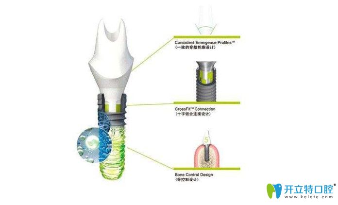 iti親水種植介紹