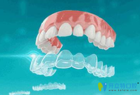 正雅和美立刻區(qū)別有哪些