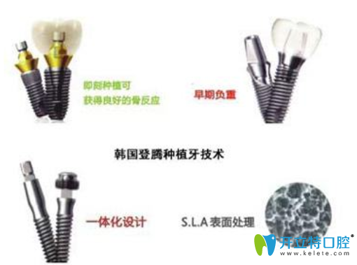 登騰種植體工藝處理