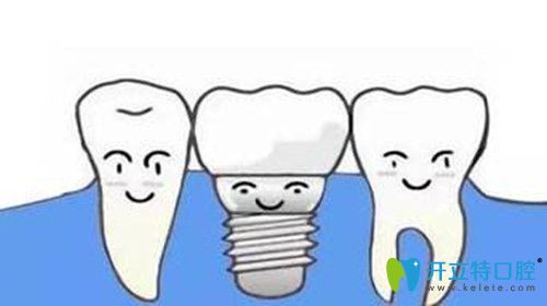 種植牙效果怎么樣