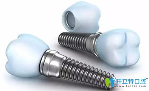 濟南韓氏口腔韓國進口種植體+仿生冠僅需4999元