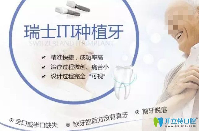 瑞士iti種植牙優(yōu)勢(shì)