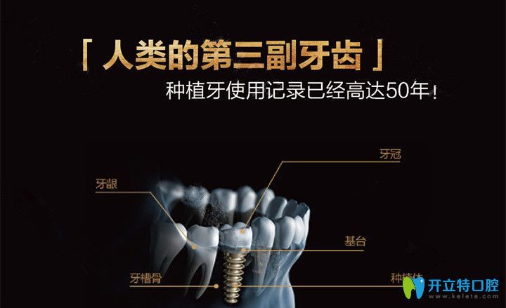 種植牙是人類的第三幅牙齒