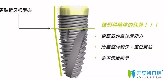 瑞士百丹特種植體的優(yōu)勢(shì)