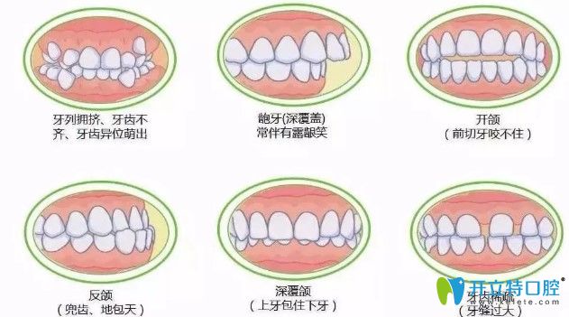 常燕醫(yī)生表示如圖所示的情況都會(huì)影響頜面發(fā)育