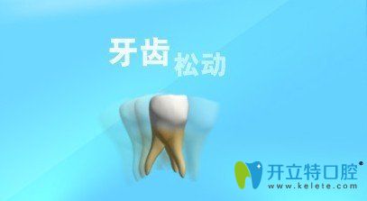 牙齒松了可以固定嗎,那些問(wèn)牙齒松了怎么拔的人怎么想的？