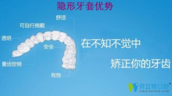 隱形牙套的優(yōu)點(diǎn)介紹圖