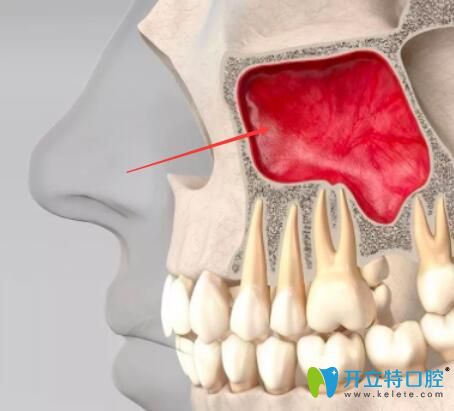 上頜竇位置圖片