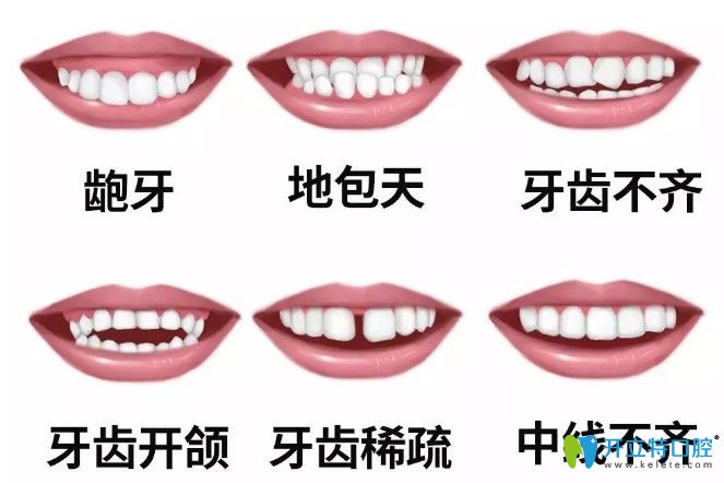 中秋不妨趁著維樂(lè)口腔牙齒矯正價(jià)格優(yōu)惠來(lái)做正畸