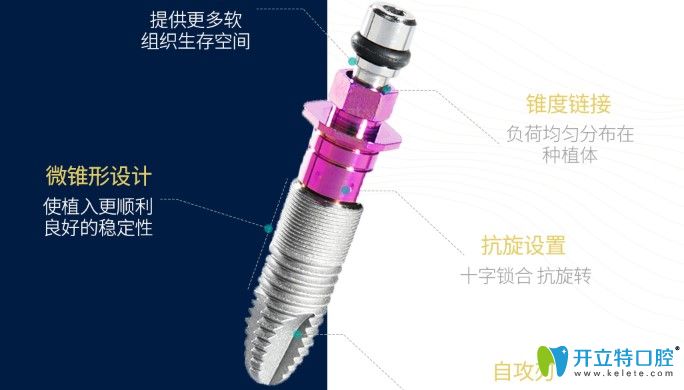 維樂(lè)口腔種植牙材料優(yōu)勢(shì)