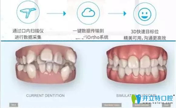 樂山英美口腔的口掃設(shè)備圖