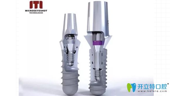 瑞士iti種植體展示圖