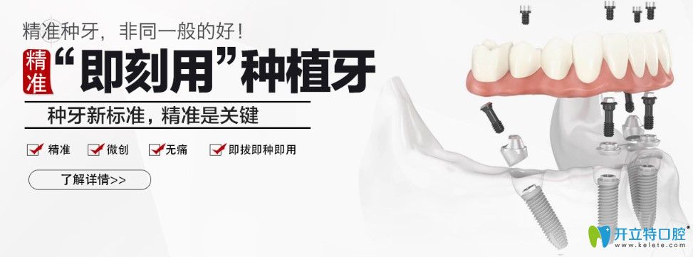 廣州廣大口腔精準(zhǔn)即刻用種植牙優(yōu)勢(shì)