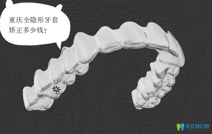 重慶隱形牙套價(jià)格表,包含隱適美和時(shí)代天使價(jià)格及醫(yī)院推薦