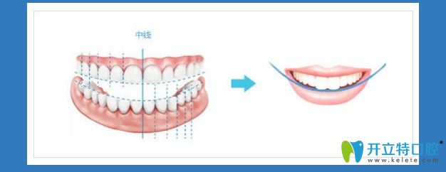 選擇虹橋做正畸的理由 選擇虹橋做正畸的理由