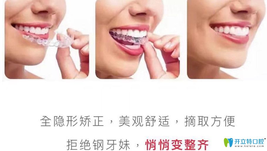 全隱形矯正距離美更進(jìn)一步