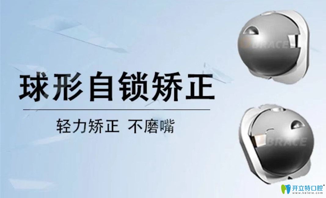 自鎖牙套的升級(jí)版球面自鎖矯正器