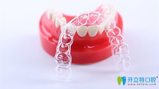 隱形矯正器怎么樣