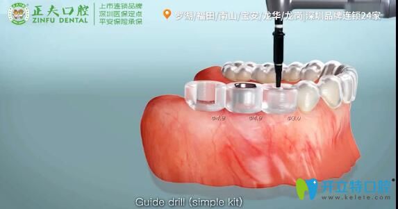 3d導板<span style=