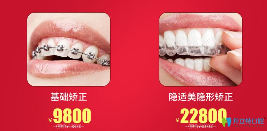 南寧柏樂口腔隱適美隱形價格表