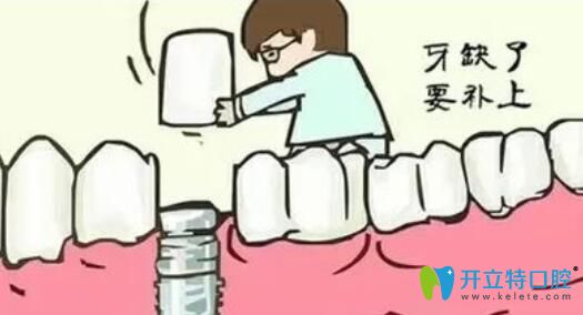 缺牙一定要補(bǔ)牙