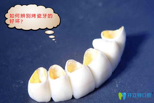 烤瓷牙是不是價(jià)格越貴越好?告訴你如何鑒別烤瓷牙的好壞