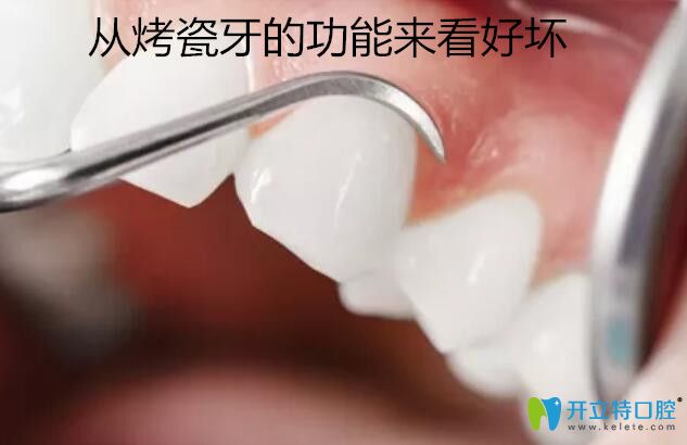 從烤瓷牙的功能來分辨好壞