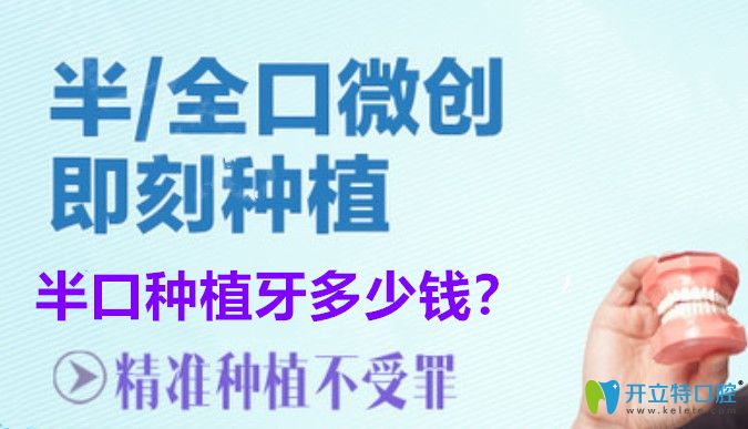 西安半口種植牙價格是多少？allon4半口即刻種植牙5萬夠嗎？