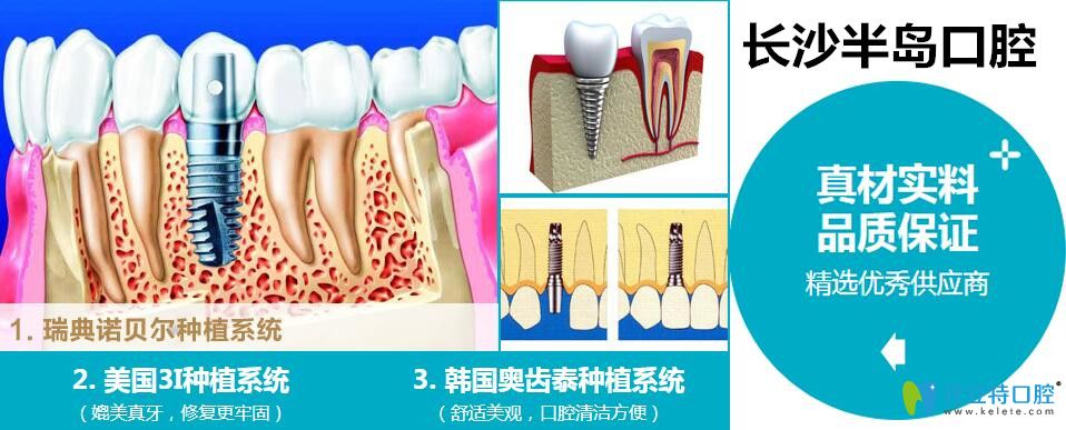<!--<i data=20240703-sp></i>-->口腔種植牙 <!--<i data=20240703-sp></i>-->口腔種植牙