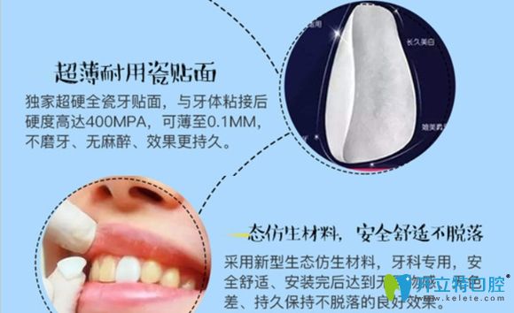 韋博口腔的E-max瓷貼面美白優(yōu)勢(shì)介紹圖 韋博口腔的E-max瓷貼面美白優(yōu)勢(shì)介紹圖
