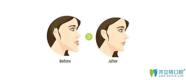 雙頜前突圖