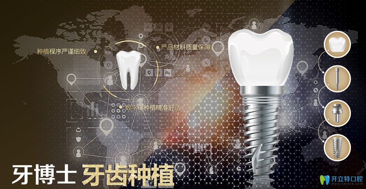 在牙博士口腔種牙還有很多優(yōu)勢哦