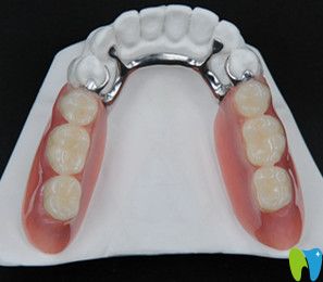 東營(yíng)鉑爾口腔張小龍醫(yī)生介紹可摘戴局部義齒修復(fù)步驟