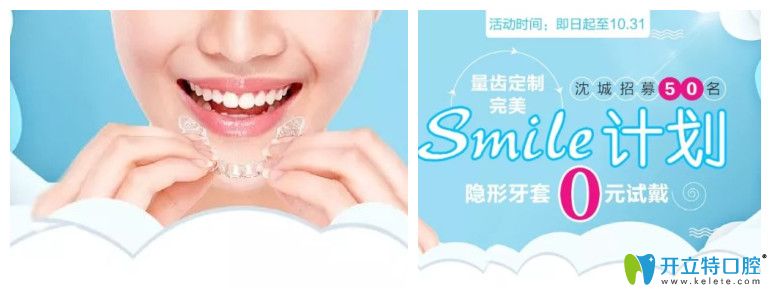 沈陽歡樂口腔0元試戴隱形牙套是真的,隱形矯正價(jià)格立減8000