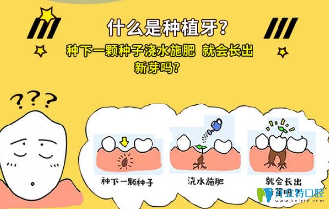 成都種植牙多少錢