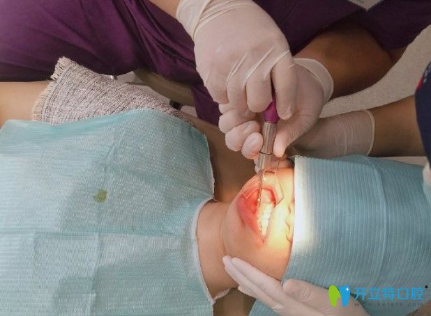 在長(zhǎng)沙中諾口腔做適美隱形矯正打支抗釘?shù)恼掌? border=