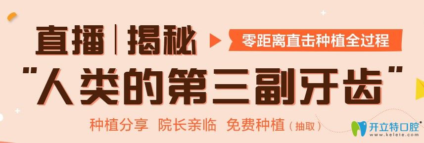 成都君臣口腔種植牙特色技術(shù)