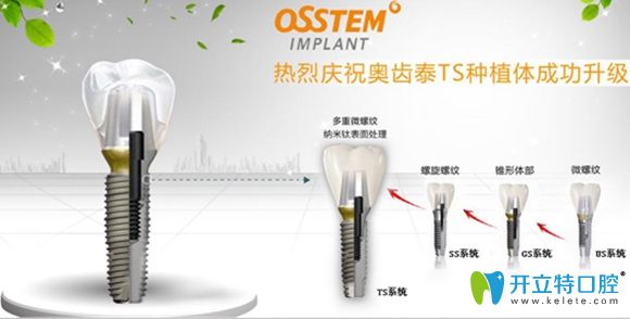 瑞士iti的效果反饋好評度要比奧齒泰略高一籌