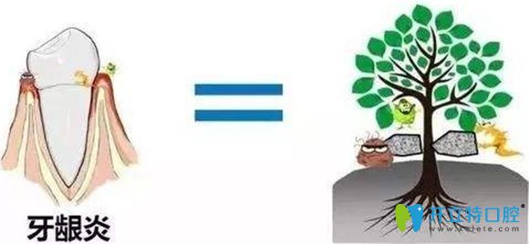 牙齦萎縮后的效果圖