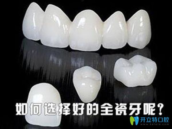 2025全瓷牙品牌排行榜及價格表-含威蘭德|愛爾創(chuàng)|澤康全瓷牙