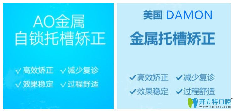 美國(guó)ao與damon自鎖托槽矯正區(qū)別是啥，哪個(gè)牙套正畸效果更好