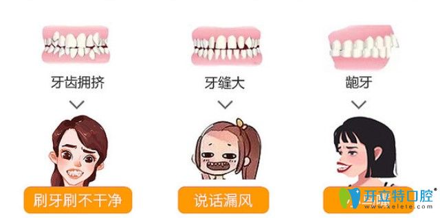 傳統(tǒng)金屬托槽固定矯正器是什么 傳統(tǒng)金屬托槽固定矯正器是什么