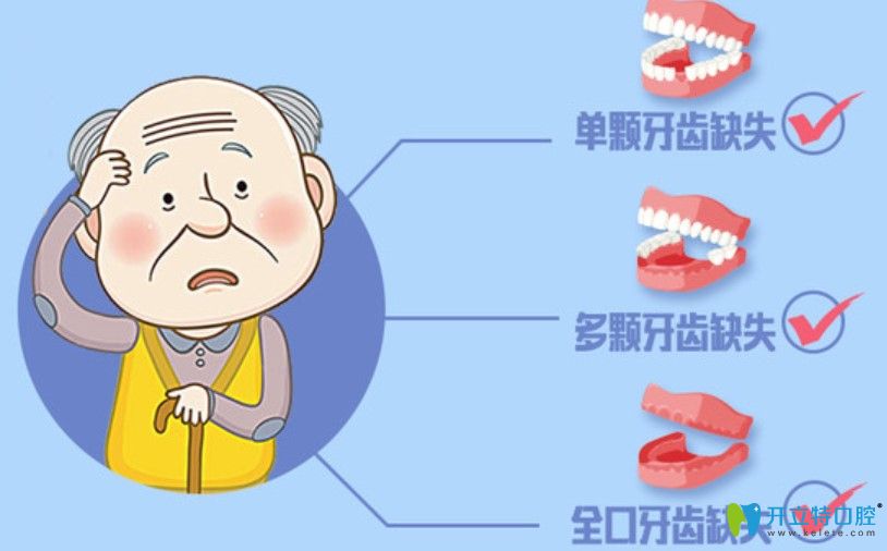 蘇州美奧口腔的微創(chuàng)即刻種植牙技術(shù)