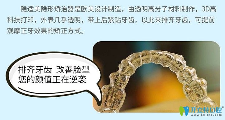 隱形牙套的優(yōu)勢(shì) 隱形牙套的優(yōu)勢(shì)