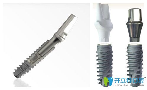 法國(guó)安卓健與諾貝爾種植體價(jià)格