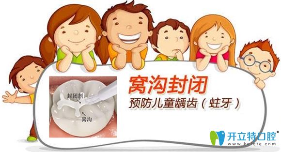 圣貝口腔窩溝封閉可預(yù)防兒童齲齒