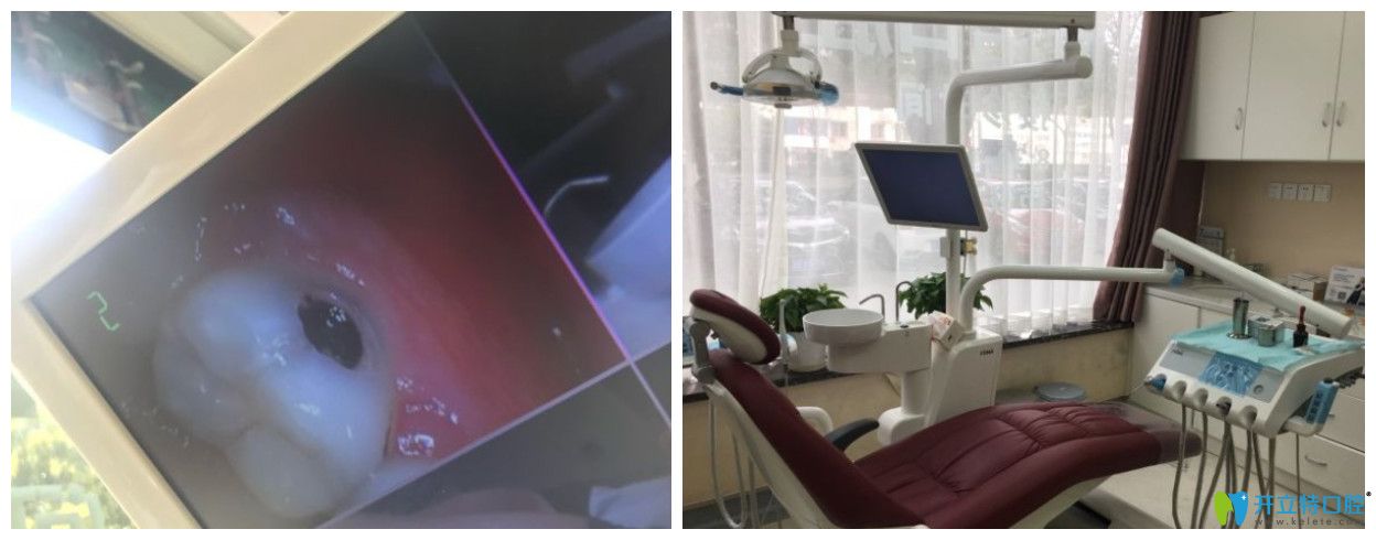 網(wǎng)友點評<!--<i data=20240703-sp></i>-->補牙好嗎