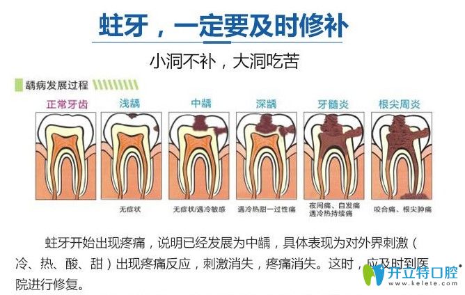 雙11圣貝牙科補(bǔ)牙也有優(yōu)惠