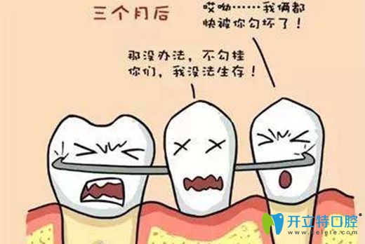 活動義齒的修復(fù)原理圖